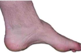 Adelaide Physio and Podiatry Clinic- CMT